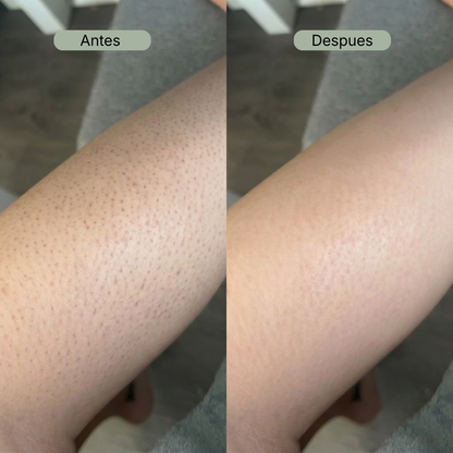 Red Exfoliante Antibacteriana Oré