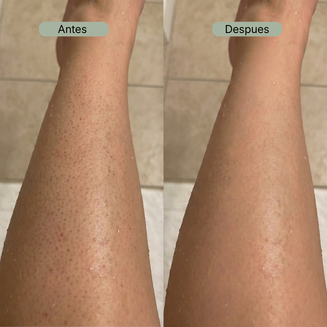 Red Exfoliante Antibacteriana Oré